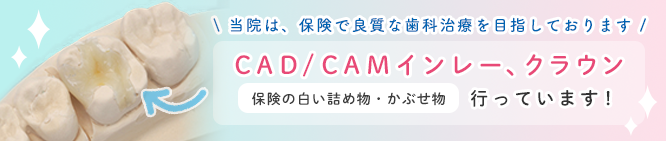 保険対応の白い詰め物、かぶせもの、CAD/CAMインレー、クラン行なっています。